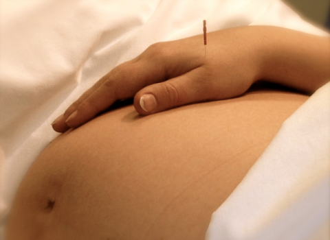 acupuncture-and-pregnancy