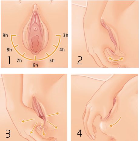 Cegah Robekan Perineum dengan Perineum Massage