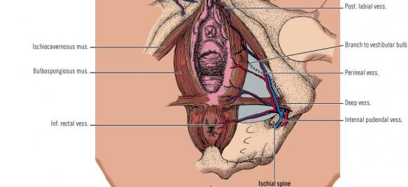 Penyebab Robekan Pada Perineum saat persalinan