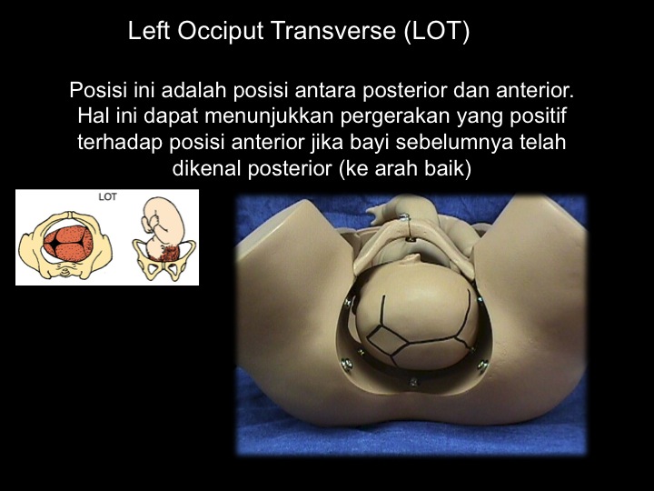 slide57