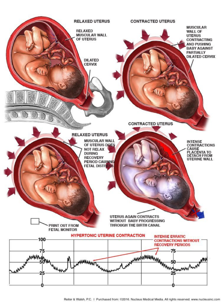 APGAR Score, Apakah Itu ?