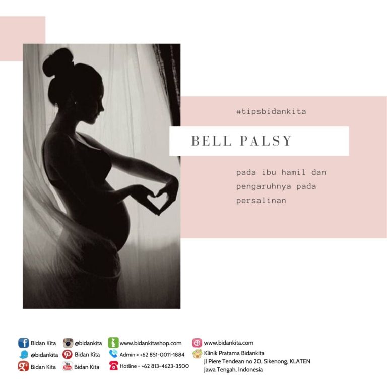 Bell’s Palsy dalam Kehamilan