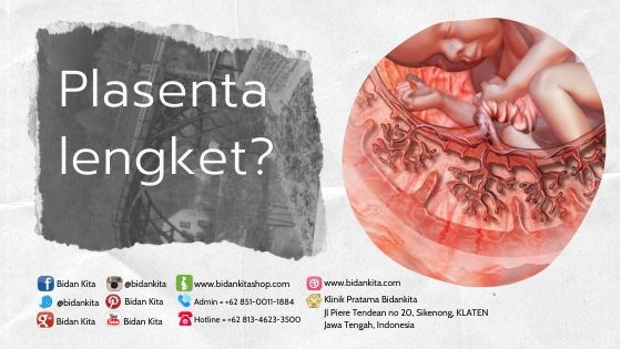 Placenta Lengket? Bagaimana ya?