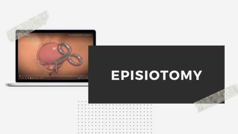 Episiotomi? Apa itu?