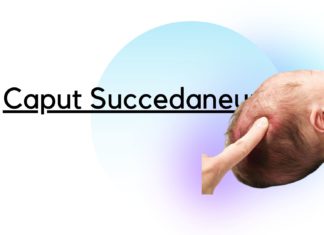 Pembengkaan di kepala bayi saat lahir? Apa penyebabnya?