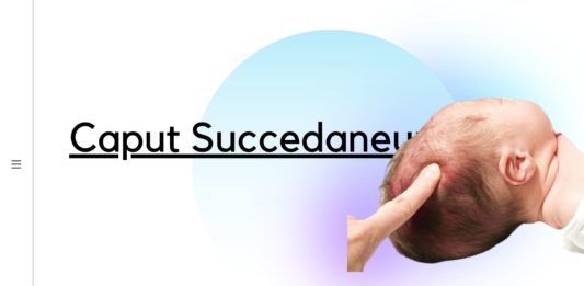 Pembengkaan di kepala bayi saat lahir? Apa penyebabnya?