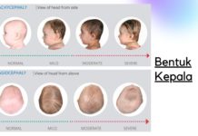 Bentuk kepala Peyang! Baguskah? Yuk kenali Brachycephaly & Plagiocephaly