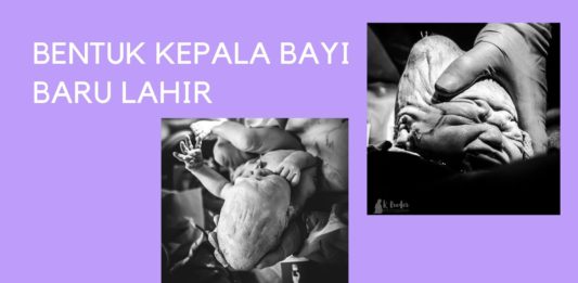 Mengapa Bentuk Kepala Bayi Baru Lahir Peyang?