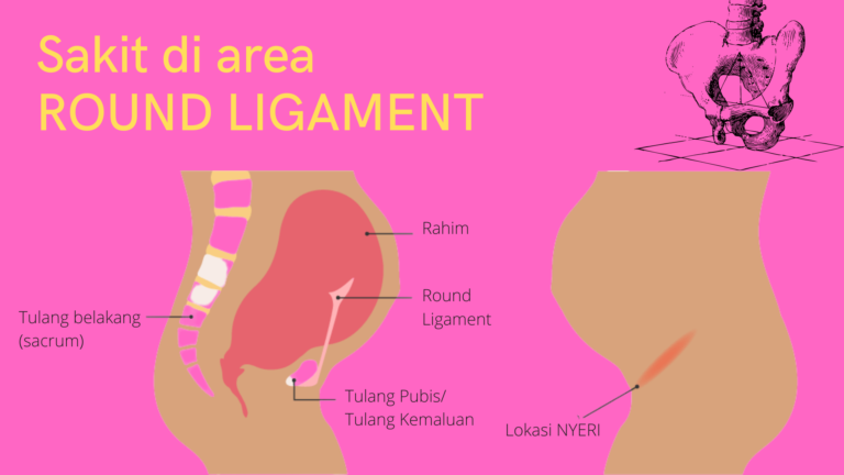Round Ligament Pain – Si Sakit di area Selakangan- dalam Persalinan