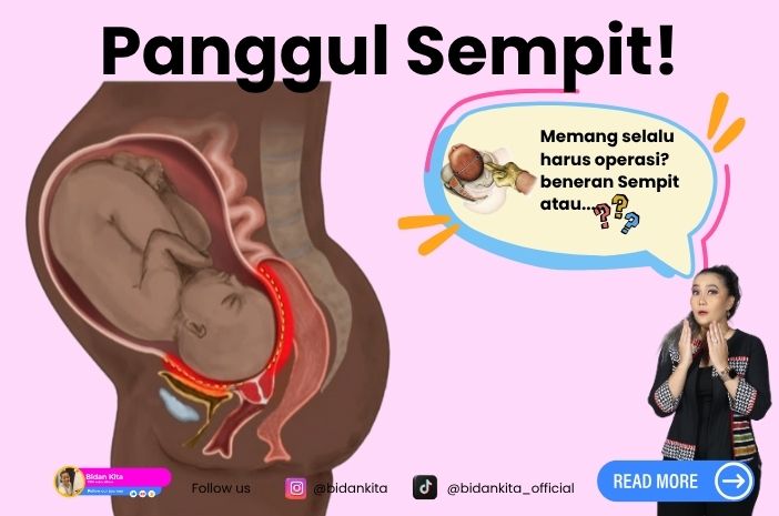 Panggul Sempit? Atau “Sistem” yang Membuatmu Ragu pada Tubuhmu Sendiri? Panggul Sempit? Atau “Sistem” yang Membuatmu Ragu pada Tubuhmu Sendiri?