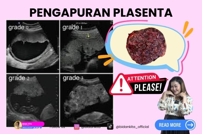 PENGAPURAN PLASENTA, BAHAYAKAH?