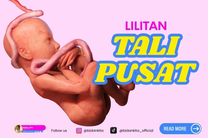 Lilitan Tali Pusat: Tak Perlu Takut, Tubuh Bayi Sudah Dirancang Cerdas oleh Tuhan