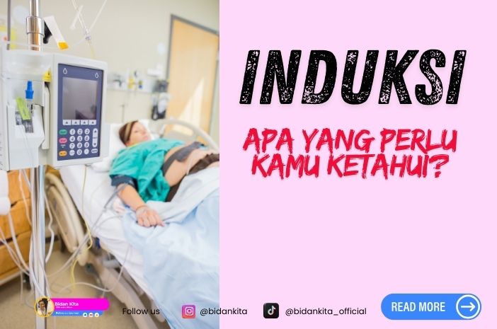 Induksi Persalinan untuk Kehamilan Lewat Waktu: Apa yang Perlu Kamu Ketahui?